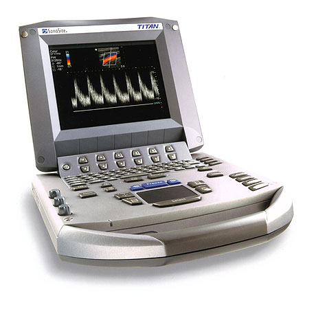 Sonosite Titan Portable Ultrasound