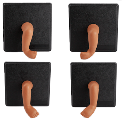 Clubfoot Stages of Correction Clubfoot Stages of Correction