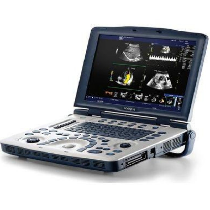 Portable Ultrasound Machines